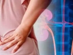 Awas, Asam Urat Bisa Berujung Batu Ginjal